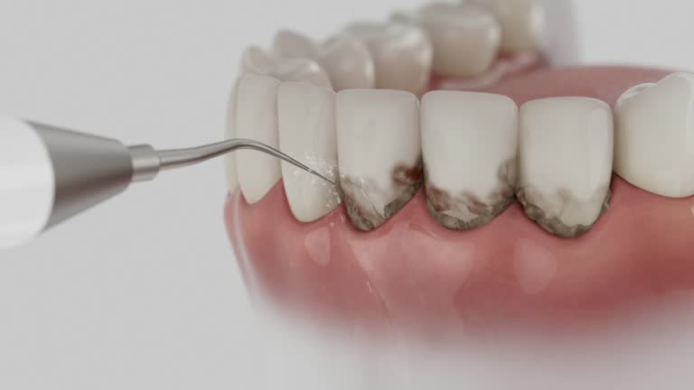 Trusted Emergency Dentist service in Parole, MD - Dentist Open Now